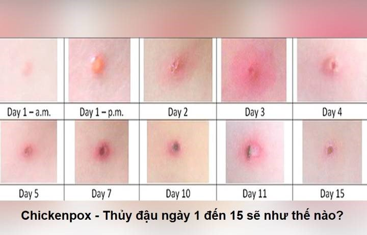 https://file.medinet.gov.vn/UploadImages/trungtamytequan11/2021_4/20190416_170213_637350_2.max-1800x1800.jpg
